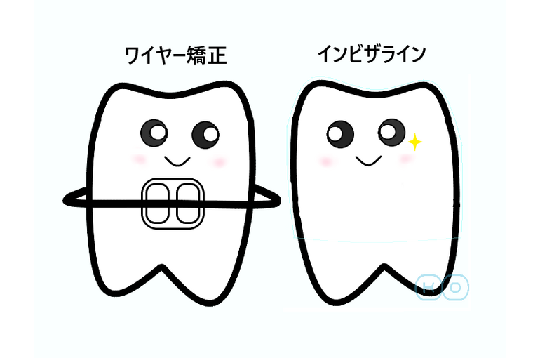 わいやー